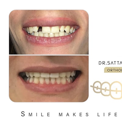 دکتر ستار کبیری متخصص ارتودنسی طرف قرارداد بیمه ایران کرج