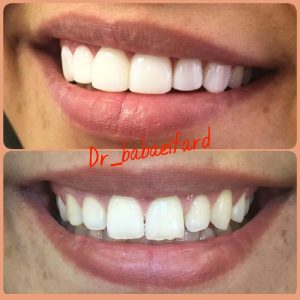 کلینیک دندانپزشکی دکتر شهاب‌الدین بابایی فرد؛ دندانپزشکی طرف قرارداد بیمه نیروهای مسلح در تهران