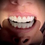 nili_dental_clinic_1681639792_3082140430765383137_39562134129