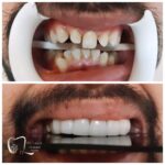 dr-laleh-abbasi (5)