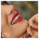 dr-laleh-abbasi (8)