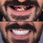 nazi-abad-dentist-takhasosi-beheshti (3)
