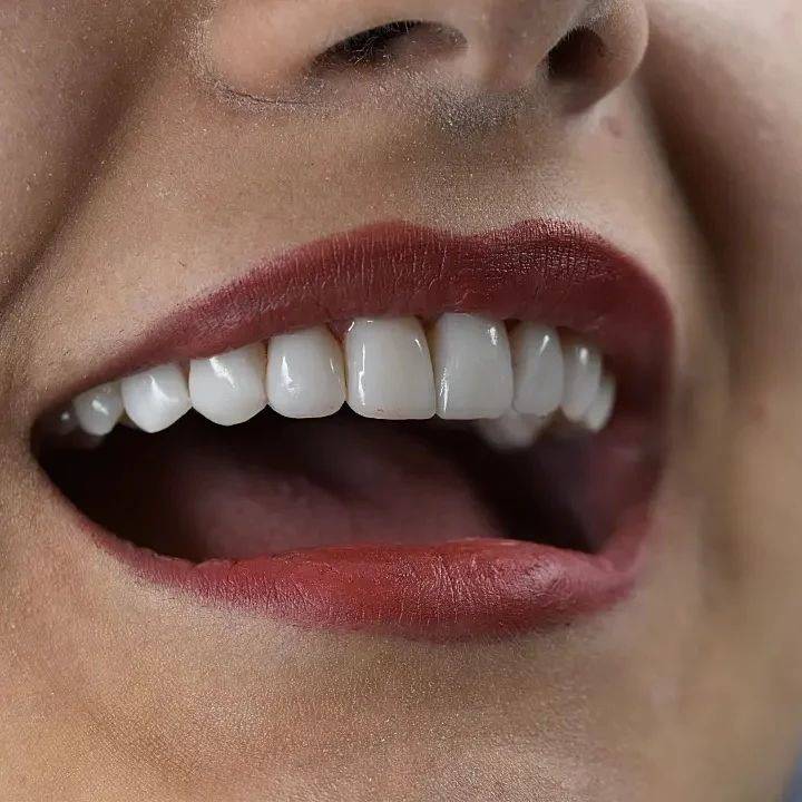 کلینیک رزگل؛ مرکز دندانپزشکی طرف قرارداد بیمه دانا در شمال تهران