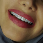 sohrabi-dental-clinic (1)