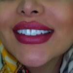 sohrabi-dental-clinic (5)