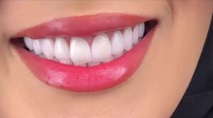 دندانپزشکی طرف قرارداد بیمه بانک مرکزی در تهران