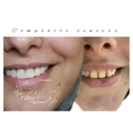 dr-ghazal-shabankareh (10)