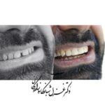 dr-ghazal-shabankareh (2)