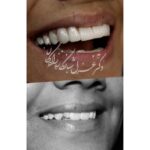 dr-ghazal-shabankareh (4)