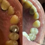 dr-ghazal-shabankareh (5)