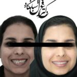 dr-ghazal-shabankareh (6)