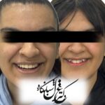 dr-ghazal-shabankareh (9)