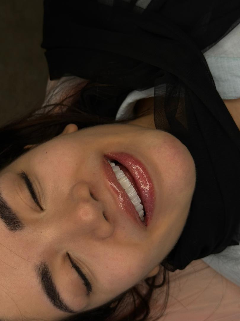 نمونه خدمات زیبایی در مرکز دندانپزشکی دکتر مرضیه حسینی، طرف قرارداد بیمه سامان در تهران