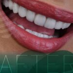 dian.dental.house_1748443770_3642532809477853768_7201166315