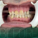 dian.dental.house_1753202270_3682450007491028812_7201166315