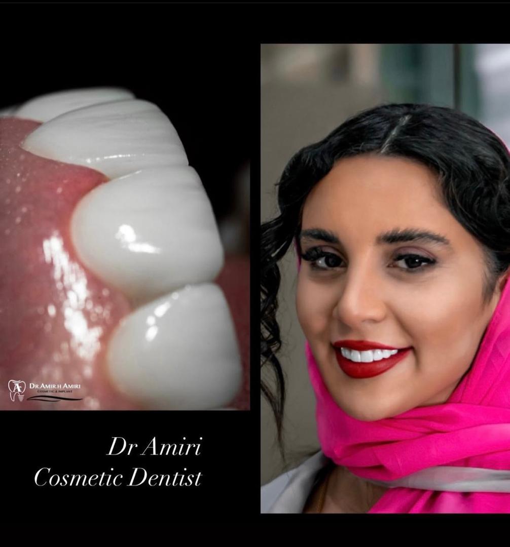 ایمپلنت دیجیتال در مرکز ایمپلنت تمام دیجیتال دکتر امیری، دندانپزشکی طرف قرارداد بیمه سامان در تهران