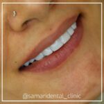 samaridental (1)