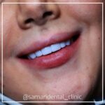 samaridental (2)