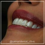 samaridental (3)