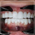 samaridental (4)