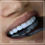 samaridental (5)