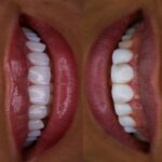 dr-sareh-ghafari (8)