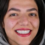 Dr.Elnaz.Sahafi (11)