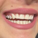 dr-sasha-sayahpour (1)