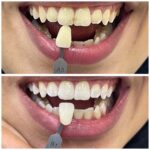 noyan-dentistry (3)