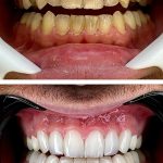 artdental (3)
