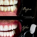 artdental (4)