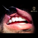 artdental (5)
