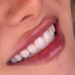mehradental