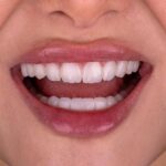 mehradental (3)