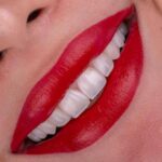 mehradental (4)