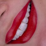 mehradental (5)