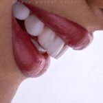 mehradental (7)