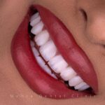 mehradental (9)