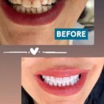 nejatdental (5)