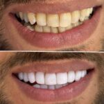 nejatdental (6)