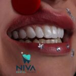 nivadental (2)