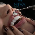 nivadental (3)