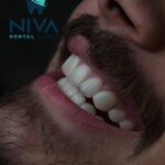 nivadental (4)