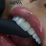 nivadental (5)