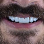 alborzdental (3)