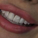 alborzdental (5)
