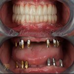 drmohamadrezabagheri (11)