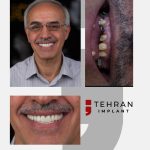 tehranimplant (4)