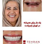 tehranimplant (6)