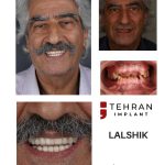 tehranimplant (7)